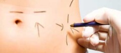 cirurgia-plastica-rondonopolis-1371136114