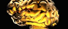 neurologia-rondonopolis-1371247465